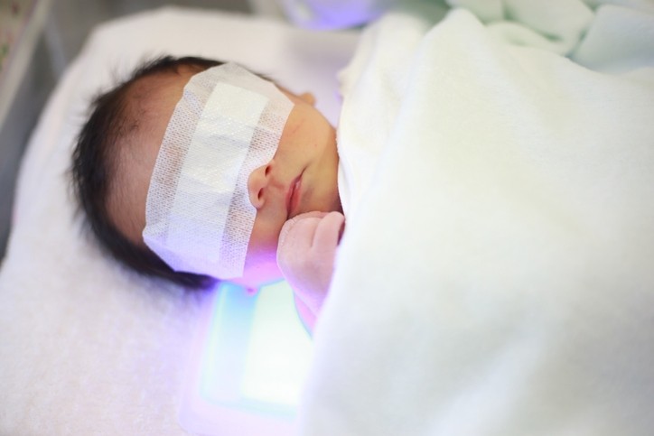 Phototherapy for neonatal jaundice © Getty Images